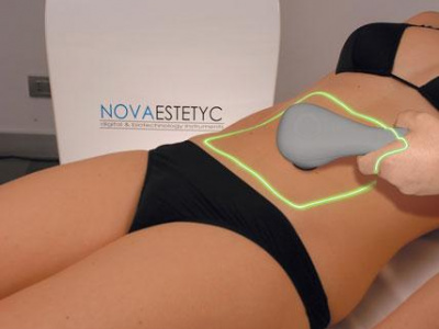 Trvalé odstránenie tuku - Bodyka